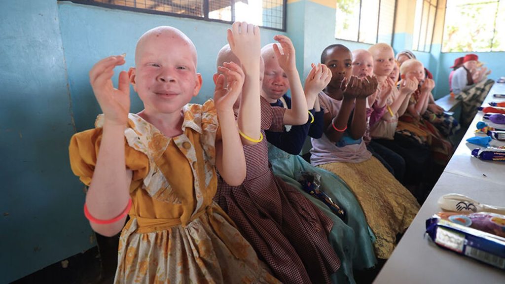 Kara kıtanın "albino" çocuklarının yüzünü TDV güldürdü